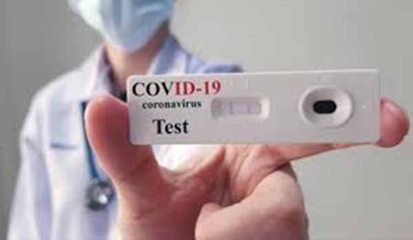 test sierologici nelle farmacie